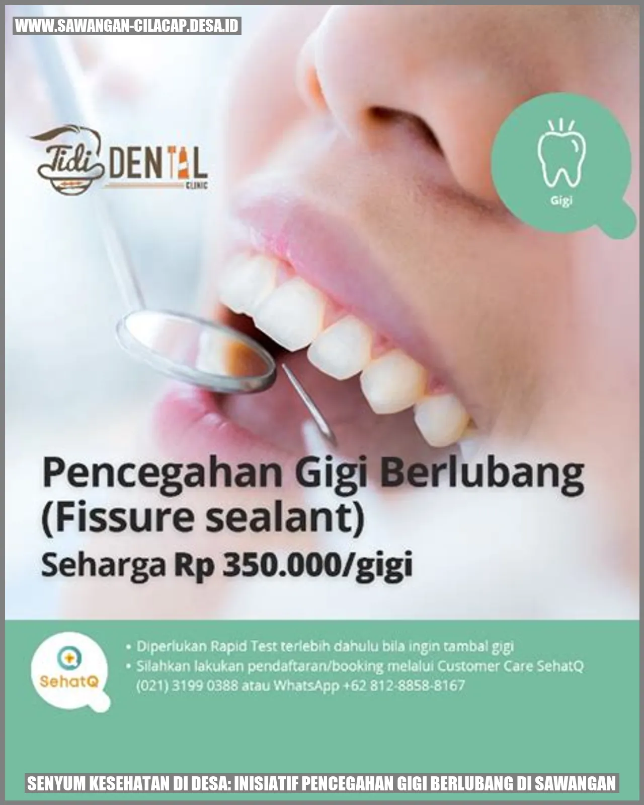 Senyum Kesehatan di Desa: Inisiatif Pencegahan Gigi Berlubang di Sawangan